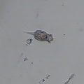 Rotifers in pond water