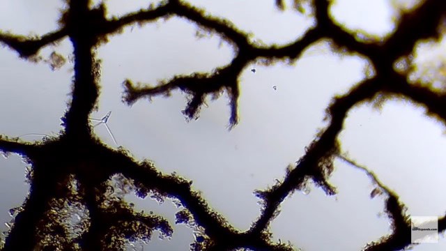 Pond life under the microscope-ozponds